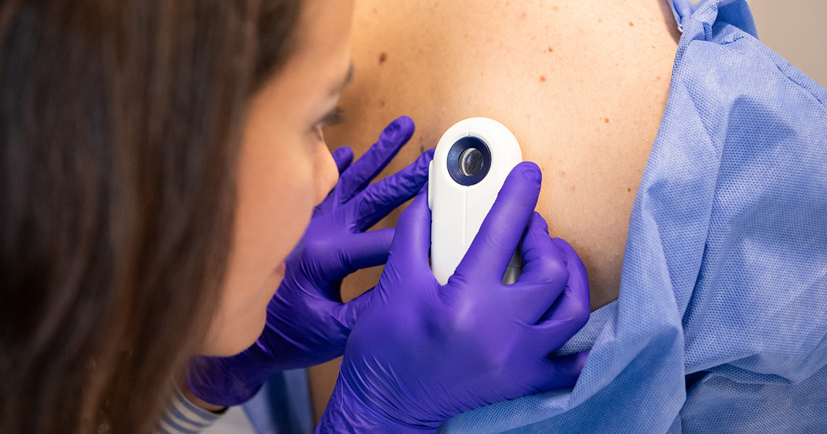 Female dermatologist examining her patient with a dermatoscope